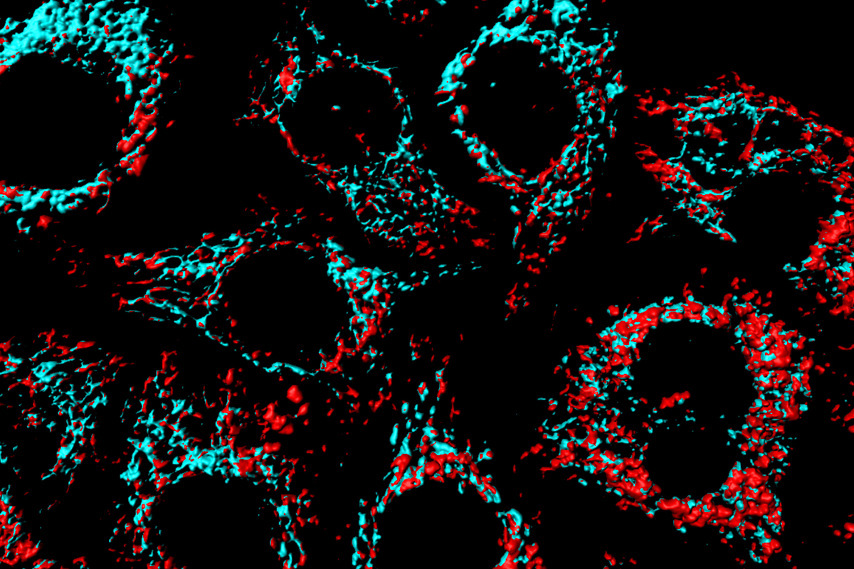 Enfermedad mitocondrial y Ortonatura