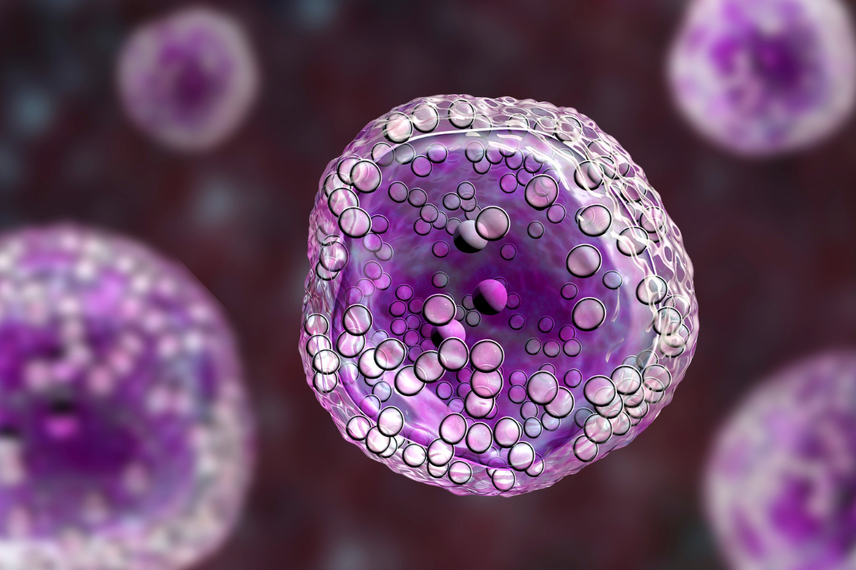 Ácido alfalipoico para linfoma